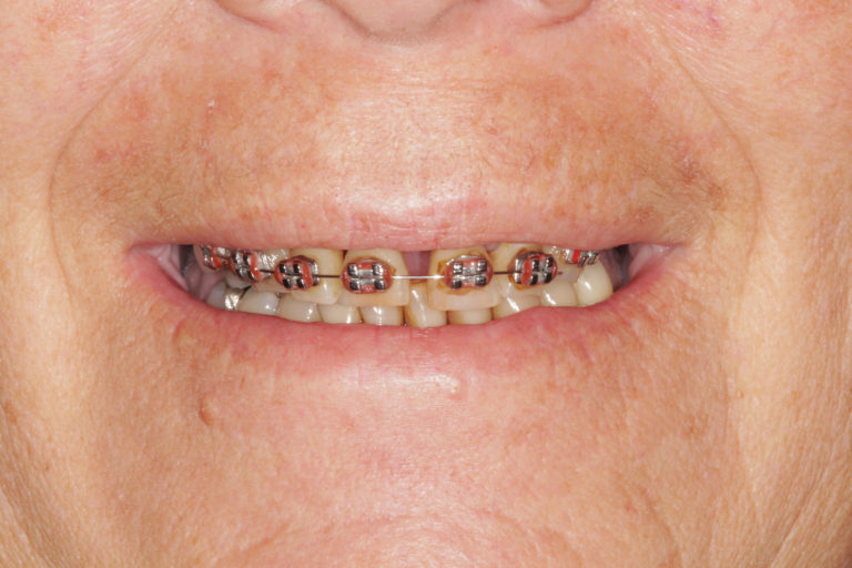 Foto Inicial - sem tratamento