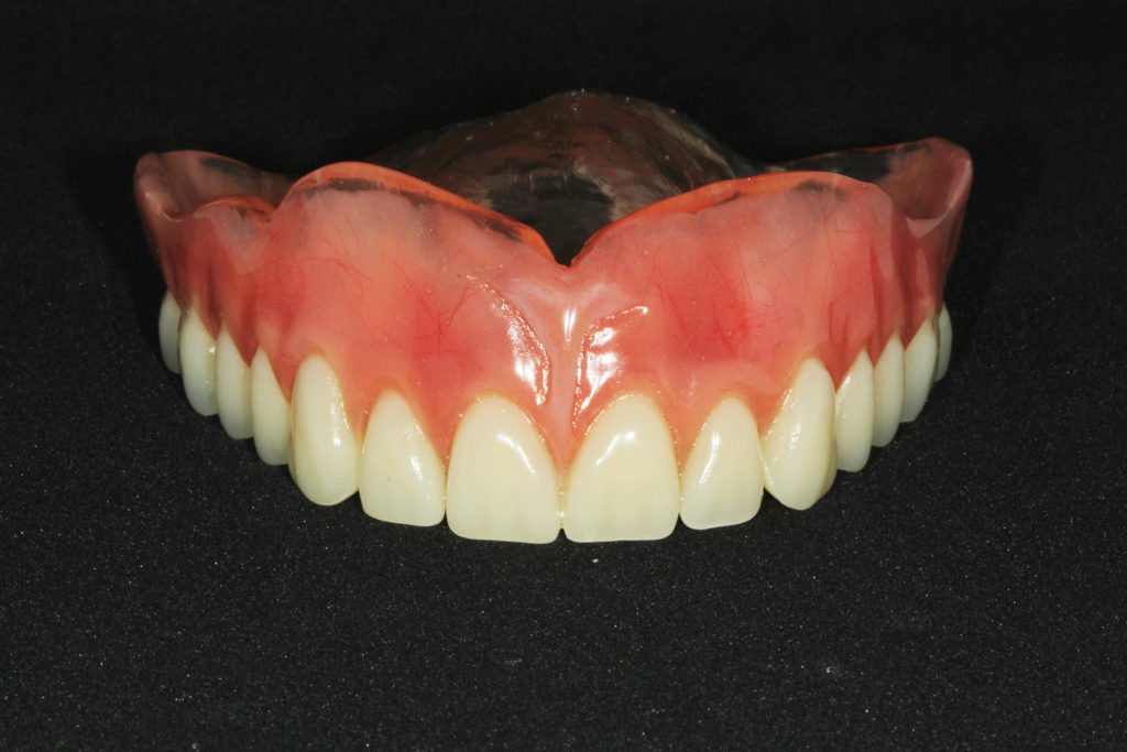 Prótese Total Superior